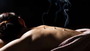 moxibustion