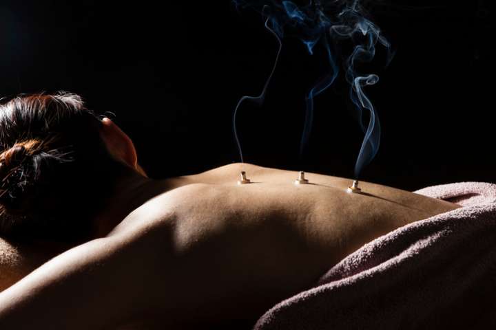 moxibustion